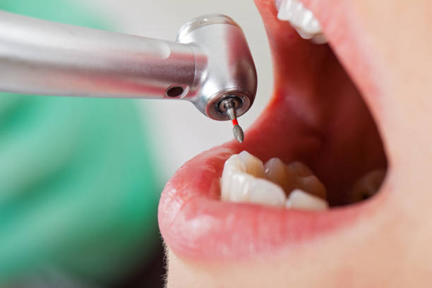 Best Emergency Treatment for Oral Infections in , FL